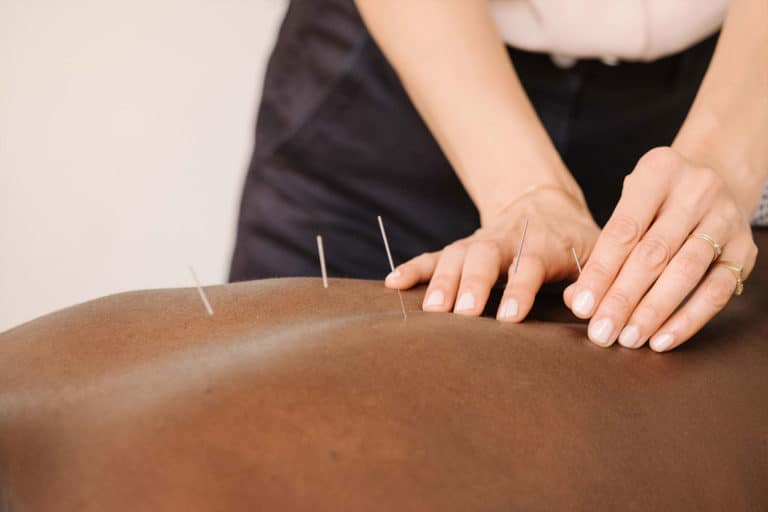 Five Seasons Healing Acupuncture Treatment