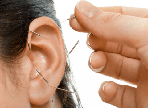 ear acupuncture for addiction