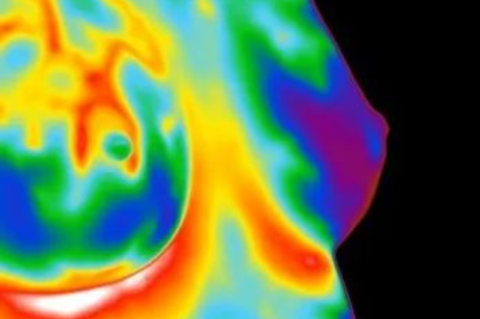 Visual of breast thermography for breast health